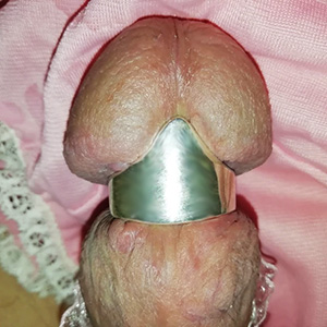 v glans cock ring